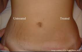 Pin On Health Diet Fitness Workout