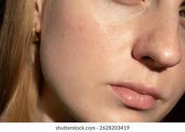 48 mil resultados de imágenes, fotos de stock e ilustraciones libres de  regalías para Cheek redness