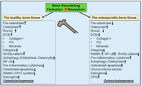Prevention and Co-Management of Breast Cancer-Related Osteoporosis Using  Resveratrol