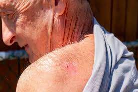 Airdrie senior attacked by dogs frustrated by lack of response