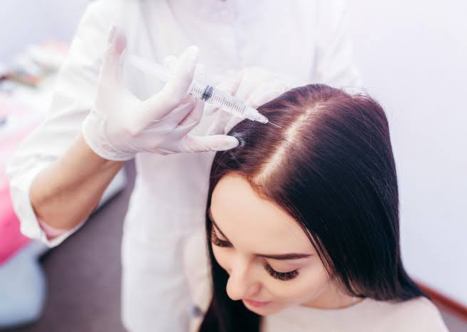 Exosome hair treatment being administered at Profrea