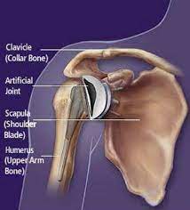 03.03.2021 · shoulder blade stock image f016 2980 science photo library photos right back shoulder pain anatomy human diagram tofu s doodles back muscles skeletal landmarks shoulder. An Example Of A Schematic Of An Artificial Shoulder Joint Download Scientific Diagram