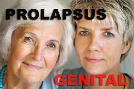 Souvent liée à l'âge, à une grossesse. Prolapsus Genital Descente D Organes Dr Bron Urologue