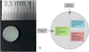 Check spelling or type a new query. Randomised In Situ Clinical Trial Investigating Self Assembling Peptide Matrix P11 4 In The Prevention Of Artificial Caries Lesions Scientific Reports