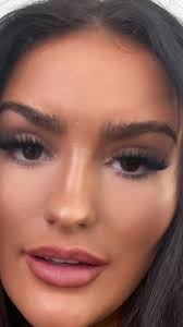 Cheek Filler Series: Fat Dissolving with Tuppence Middleton