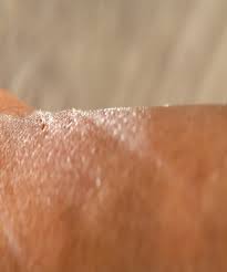 Dehidrasi akan membuat kulit menjadi kering yang dapat memicu kulit bersisik dan kusam. Cara Mengatasi Kulit Kering Ini Terbukti Efektif Mudah Sudah Tahu
