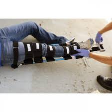 Image result for Femur Traction Splint