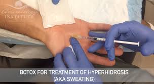 Full safety & prescribing info, including boxed warning. Botox Treatment For Excessive Sweating In Los Angeles