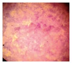 Image result for Triumfetta welwitschii