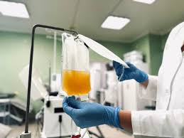 Image result for Plasma Transfusion