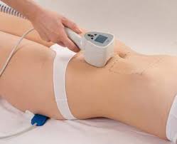 Using Vitamin C To Minimize Stretch Marks