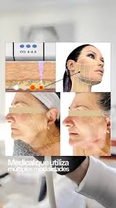 🔬 **CIENCIA, TECNOLOGÍA Y ARTE EN UN SOLO PROTOCOLO** Así transformamos la  biología del rostro en cada sesión…, Hoy te muestro cómo aplicamos mi  exclusivo **método SCULPTOR V LIFTING EFFECT®** ...