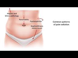 An Approach To Acute Abdominal Pain Youtube