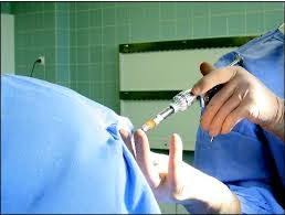 Quelles sont les causes et symptômes des hémorroïdes externes ? Hemorroides Encyclopedie Medicale