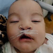 TESS Sin Límites Guatemala...