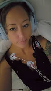 Insurance covers hip brace for hypermobility