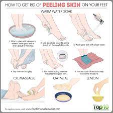 Do you have dead skin on your feet? How To Get Rid Of Peeling Skin On Your Feet Top 10 Home Remedies