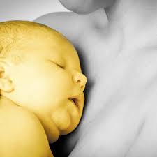 Image result for Kernicterus