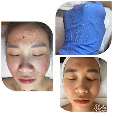 TOP 10 BEST Facials Spa in Alpharetta, GA