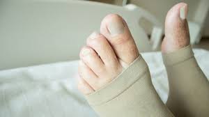 Thrombose Anzeichen Und Symptome Rechtzeitig Erkennen Ndr De Ratgeber Gesundheit