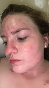 Dealing with painful medical treatments and unfriendly clinic staff