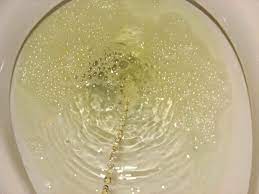 We did not find results for: 15 Ways Your Urine Can Tell Surich Uva Jhoilyn Bacolod Facebook