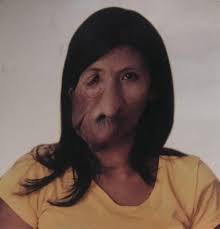 Ginang na may kakaibang sakit, kilalanin sa 'Tunay na Buhay'