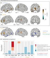 7.1 3b proportional relationship word problem. Shared And Modality Specific Brain Regions That Mediate Auditory And Visual Word Comprehension Elife