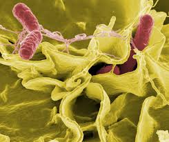 Description la légionellose est une maladie causée par une bactérie appelée legionella pneumophila. Le Diagnostic Legionellose Edi