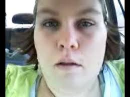 Fourth cranial nerve palsy or trochlear nerve palsy, is a condition affecting cranial nerve 4 (iv), the trochlear nerve, which is one of the cranial nerves.it causes weakness or paralysis of the superior oblique muscle that it innervates. Trying To Grin Bells Palsy Grin Face