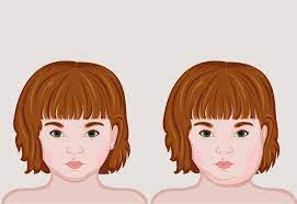 Schwerhorigkeit Und Mumps Wie Ist Der Zusammenhang