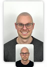 Oscar Arango Micropigmentación capilar