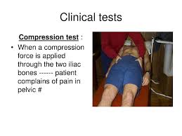 Image result for Pelvic Compression Test