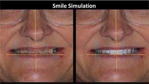 Accurate Down to the Micron by Dr. Cory Glenn with Dr. Danny Domingue