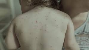 17 نصيحة تساعد على النوم بشكل أفضل صحتنا