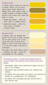 Image result for acholic stools human