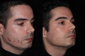 Clinical Casebook M22™ Treatments