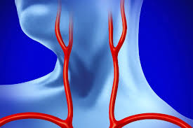 Image result for carotid artery