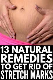 Pin On Stretch Marks Preventing Stretch Marks Get Rid Of Stretch Marks Stretch Marks Remedies Pregnancy Breasts Thighs Butt