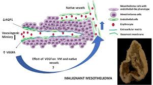 Maybe you would like to learn more about one of these? Ijms Free Full Text The Effect Of Aquaporin 1 Inhibition On Vasculogenic Mimicry In Malignant Mesothelioma Html