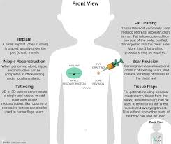Brca2 mutations increase the risk of breast cancer in men more than they increase the risk in women. Pin On Male Breast Cancer