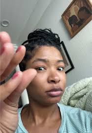 My lanta 🙄😂 I was icing it literally until I fell asleep and took a  Benadryl just in case it was an allergic reaction #facialsteamer #becareful  #closecall #greenscreen