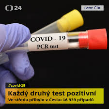 V česku je test na covid, který si může udělat každý sám. Ct24 Kazdy Druhy Stredecni Odebrany Vzorek Byl Ve Stredu Pozitivni Na Covid 19 Podobne Jako To Bylo V Utery Od Stredy Se Zhorsily Vsechny Ukazatele Z Kterych Se Pocita Rizikovy Index