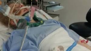 G explains how most car accident victims die from natural causes before or during the crash. Stormont Compensation Car Crash Victim Helpless Over Delay Bbc News