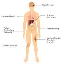 Plasmodium falciparum infection carries a. Malaria Symptome Typische Anzeichen Erkennen Was Tun