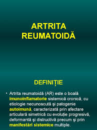 Poate ca intre timp boala a avansat mult. Artrita Reumatoida Tratament Moldamin Move Flex Gel In Romania