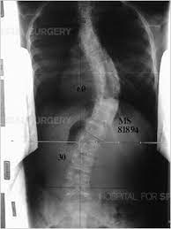Pin On X Ray Pathology