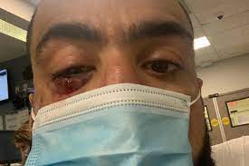 Chris curtis vs belal muhammad. Ufc Fight Night 187 Belal Muhammad Reports No Serious Damage To Eye
