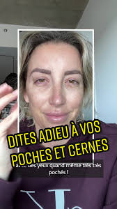 Test du masseur pour yeux, cernes et poches ! Le AVANT