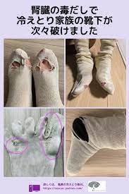 冬の腎臓の毒だしで冷えとり家族の靴下が次々破けましたの巻 冷えとり毎日レスキュー女子es 腎臓 冷えとり靴下 足つぼ